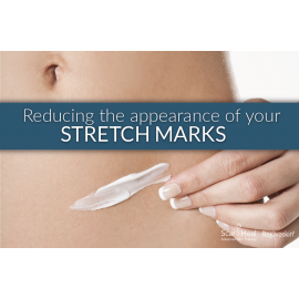 Rejuvaskin Advanced Stretch Mark Cream 60ML 