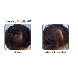 Hair Dr. Follicle Serum 50ML 